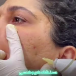 تصویر کلینیک زیبایی و مرکز لیزر V