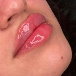 تصویر کلینیک زیبایی پوست و لیزر بلاریا