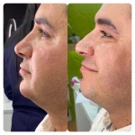 نمونه کار کلینیک پوست، مو و لیزر تی تی