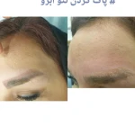 مرکز لیزرو کلینیک زیبایی طراوت