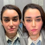 کلینیک زیبایی دکتر یوسف زادگان
