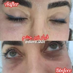 کلینیک زیبایی و مرکز لیزر و هایفو مرکز دلورا