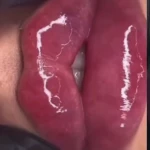 مطب پوست، مو و زیبایی و لیزر شبیرا