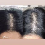 کلینیک زیبایی و مرکز لیزر سنسیا