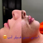  مرکز لیزرو پوست و طب سوزنی الماس تابان