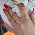 کلینیک پوست و زیبایی ماری