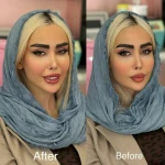 کلینیک زیبایی بلا