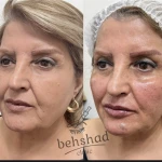 کلینیک تخصصی پوست و زیبایی بهشاد