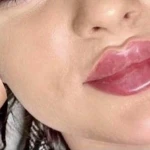 نمونه کار مطب پوست ،مو،زیبایی(دکتر سمیرا گرجی)