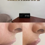 کلینیک لیزر و زیبایی البرز