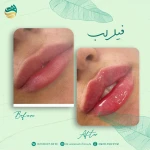 کلینیک پوست,مو و لاغری دادمان