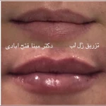 کلینیک تخصصی پوست دکتر مینا فتح آبادی