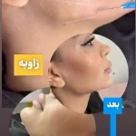 کلینیک زیبایی رایکا