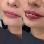 کلینیک تخصصی لیزر نوران