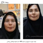 نمونه کار مطب زیبایی zh one دکتر زینب هاشمی