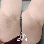  کلینیک زیبایی آروین