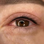 کاشت مژه و میکرو بلیدینگ رها