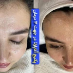 نمونه کار کلینیک تخصصی پوست و مو بهاره محمدحسینی