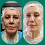 کلینیک زیبایی و لاغری یسنا