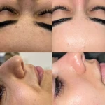 خدمات تخصصی پاکسازی پوست ساجده عنایتی