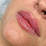 نمونه کار کلینیک پوست مو زیبایی دکتر حسینی