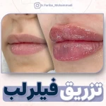 مرکز پوست ،مو و زیبایی دکتر فریبا محمدی