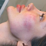 کلینیک لیزر پوست و مو زیبایی توکا