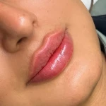 کلینیک زیبایی لیلاک