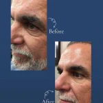 کلینیک زیبایی و مرکز لیزر ماری اسکین
