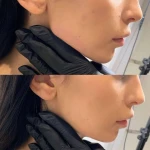 نمونه کار کلینیک زیبایی پارسیان آلفا