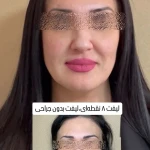 کلینیک لیزر وکلینیک زیبایی پایون(بانوان)