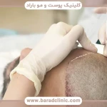 تصویر کلینیک پوست مو و زیبایی و کاشت مو باراد