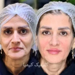 کلینیک پوست مو زیبایی و لیزر کیمیا