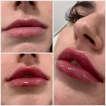 تصویر کلینیک پوست مو زیبایی و لیزر آیسل