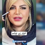 کلینیک پوست و مو الیزه