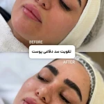 خدمات فیشال و پاکسازی پوست افروز