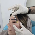 کلینیک زیبایی و لیزر مو گندم