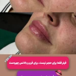 مرکز خدمات پوست و مو  لیزر و زیبایی یاس