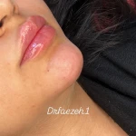 مرکز لیزر و زیبایی نویامِد