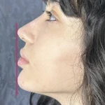 کلینیک زیبایی و لیزر دکتر حکیم پور