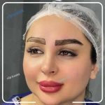 مرکز کاشت مو و ابرو فیشال cip