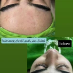 سالن زیبایی اکستنشن شرق - زیبایی طبیعی