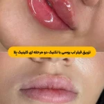 کلینیک زیبایی بلا