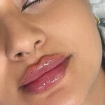 نمونه کار کلینیک زیبایی لیلاک