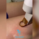 تصویر کلینیک زیبایی آوا بیوتی