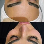 فشیال و پاکسازی پوست اوپال