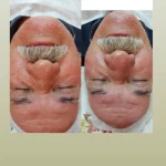 خدمات تخصصی پوست و مو مریم نصیرپور