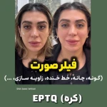 کلینیک آیریس