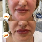 مرکز پوست مو زیبایی رز طلایی