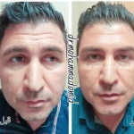  دکتر محمد امید بهترین دکتر زیبایی کانتور